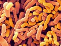 母乳益生菌Bifidobacterium bifidum  (比菲德氏菌) 